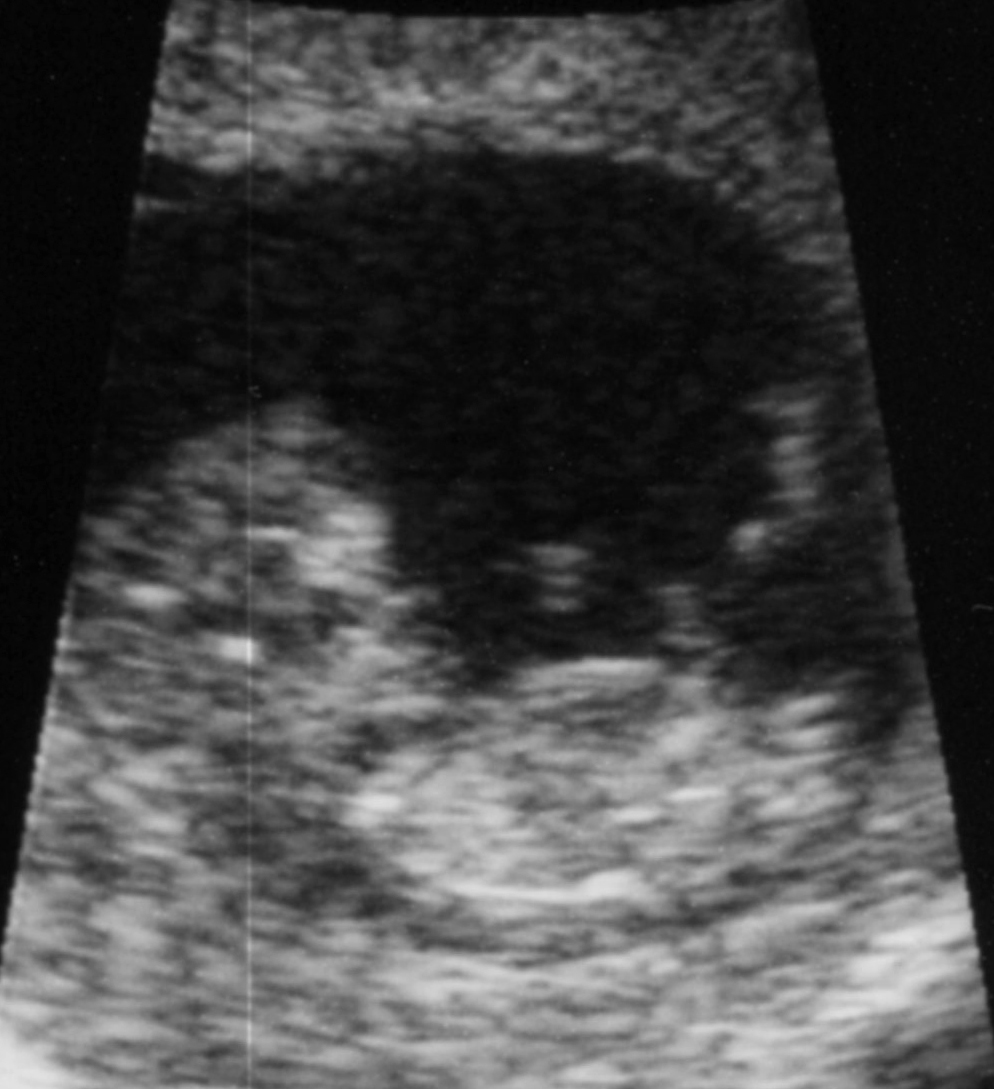 Ultrasound-close up.jpg