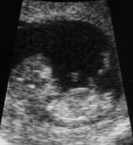 Ultrasound-close up.jpg